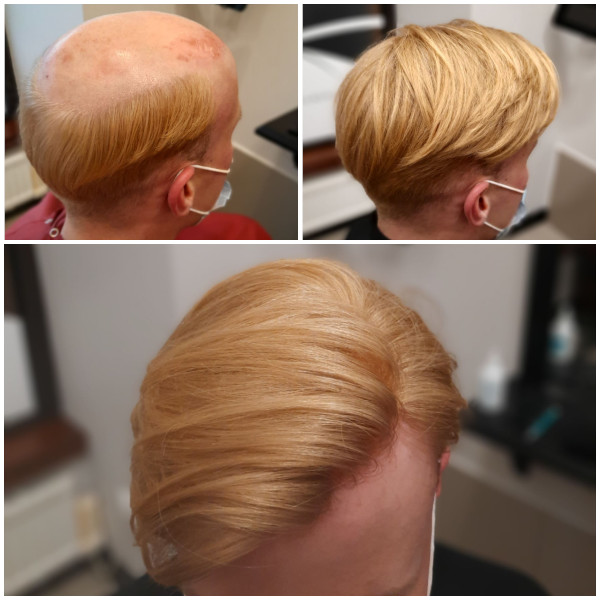 topper efekt przed i po