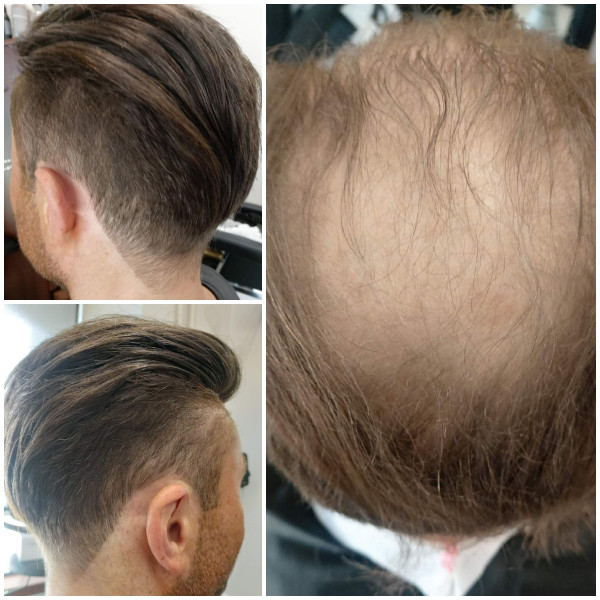 topper efekt przed i po