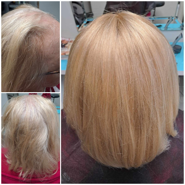 naturalny topper efekt przed i po